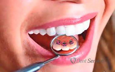 Патологія зубного ряду? Ортодонтичне лікування в стоматології «Dent Service»